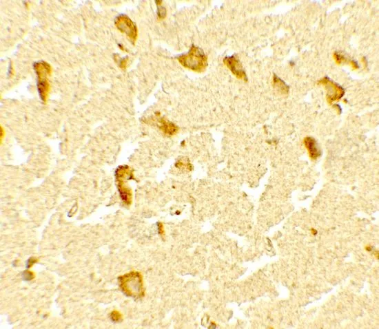 IHC-P analysis of human brain tissue using GTX31560 CERD4 antibody. Working concentration : 5 microg/ml IHC-P analysis of human brain tissue using GTX31560 CERD4 antibody. Working concentration : 5 microg/ml