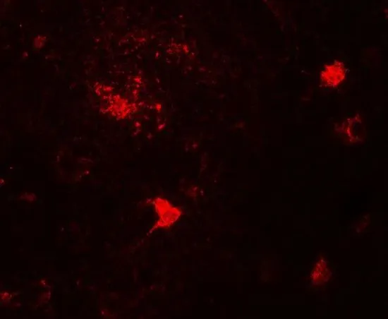 IHC-P analysis of human brain tissue using GTX31560 CERD4 antibody. Working concentration : 20 microg/ml
