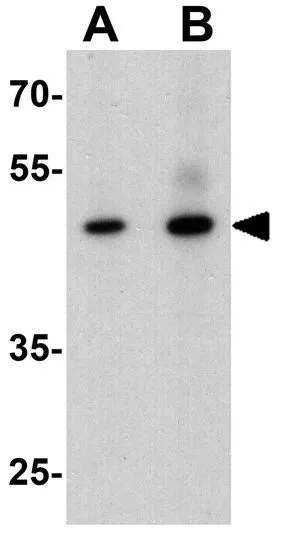 WB analysis of mouse brain tissue lysate using GTX31560 CERD4 antibody. Working concentration : (A) 1 and (B) 2 microg/ml