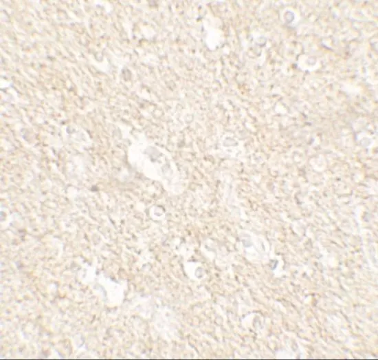 IHC-P analysis of human brain tissue using GTX31561 APPBP2 antibody. Working concentration : 5 microg/ml IHC-P analysis of human brain tissue using GTX31561 APPBP2 antibody. Working concentration : 5 microg/ml
