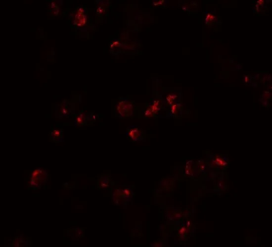 ICC/IF analysis of HeLa cells using GTX31563 IL22 antibody. Working concentration : 20 microg/ml