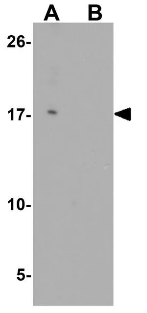 WB analysis of HeLa cell lysate in (A) the absence and (B) the presence of blocking peptide using GTX31563 IL22 antibody. Working concentration : 0.5 microg/ml