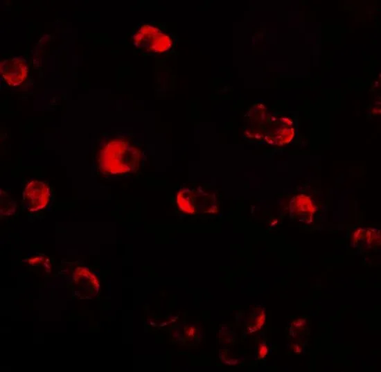ICC/IF analysis of HepG2 cells using GTX31572 OASL antibody. Working concentration : 20 microg/ml