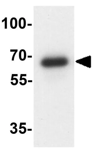 WB analysis of mouse bladder tissue lysate using GTX31572 OASL antibody. Working concentration : 1 microg/ml