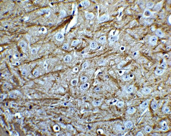 IHC-P analysis of mouse brain tissue using GTX31581 PINK1 antibody. Working concentration : 5 microg/ml IHC-P analysis of mouse brain tissue using GTX31581 PINK1 antibody. Working concentration : 5 microg/ml
