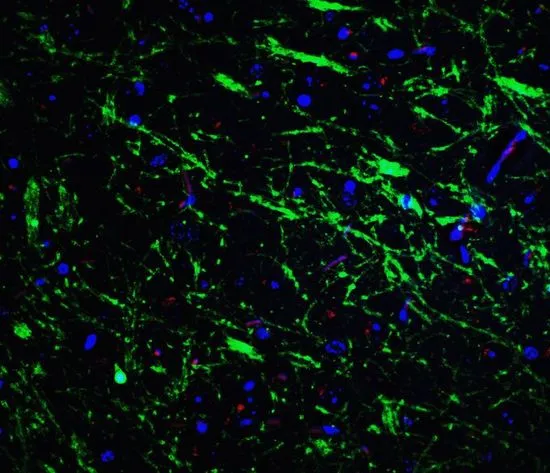 IHC-P analysis of mouse brain tissue using GTX31581 PINK1 antibody. Working concentration : 20 microg/ml Green : Primary antibody Blue : DAPI Red : Actin