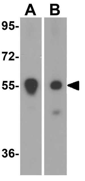 WB analysis of (A) mouse and (B) rat spleen tissue lysate using GTX31581 PINK1 antibody. Working concentration : 1 microg/ml