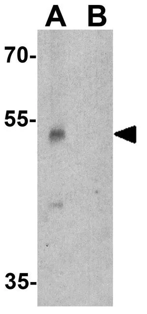 WB analysis of A431 cell lysate in (A) the absence and (B) the presence of blocking peptide using GTX31581 PINK1 antibody. Working concentration : 1 microg/ml