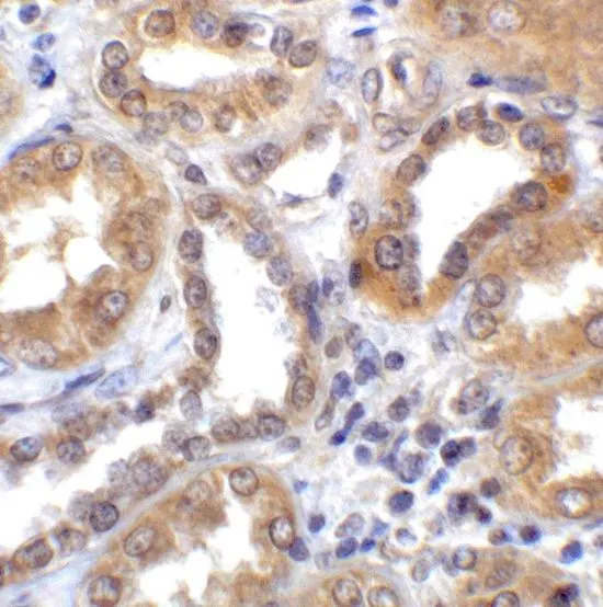 IHC-P analysis of human kidney tissue using GTX31592 TXNIP antibody. Working concentration : 2 microg/ml IHC-P analysis of human kidney tissue using GTX31592 TXNIP antibody. Working concentration : 2 microg/ml