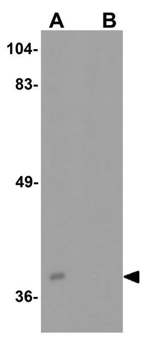 WB analysis of C2C12 cell lysate in (A) the absence and (B) the presence of blocking peptide using GTX31592 TXNIP antibody. Working concentration : 0.5 microg/ml