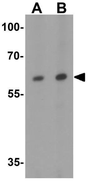 WB analysis of 293 cell lysate using GTX31594 Vezatin antibody. Working concentration : (A) 1 and (B) 2 microg/ml