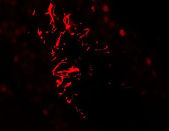 IHC-P analysis of human testis tissue using GTX31595 AKAP 82 antibody. Working concentration : 20 microg/ml
