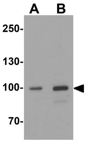 WB analysis of human testis tissue lysate using GTX31595 AKAP 82 antibody. Working concentration : (A) 1 and (B) 2 microg/ml