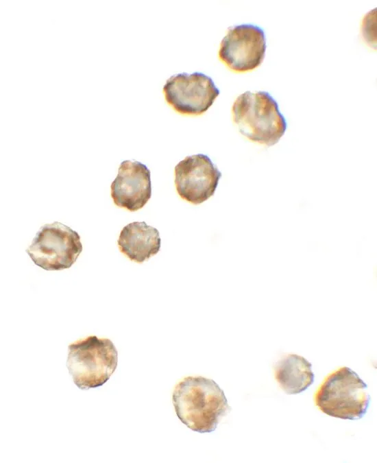 ICC/IF analysis of 3T3 cells using GTX31600 P2X7 antibody. Working concentration : 5 microg/ml ICC/IF analysis of 3T3 cells using GTX31600 P2X7 antibody. Working concentration : 5 microg/ml