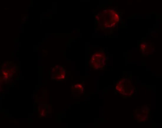 ICC/IF analysis of 3T3 cells using GTX31600 P2X7 antibody. Working concentration : 20 microg/ml