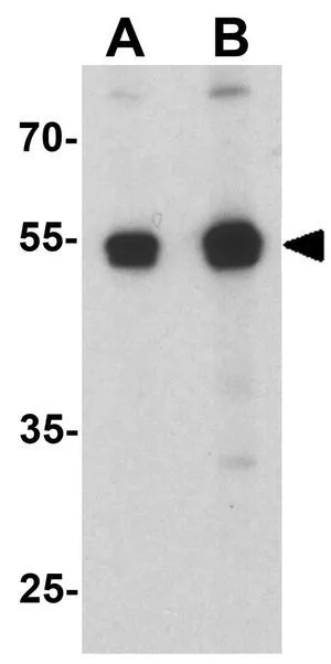 WB analysis of 3T3 cell lysate using GTX31600 P2X7 antibody. Working concentration : (A) 1 and (B) 2 microg/ml