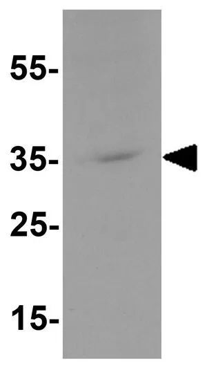 WB analysis of 3T3 cell lysate using GTX31601 KCNK1 antibody. Working concentration : 1 microg/ml