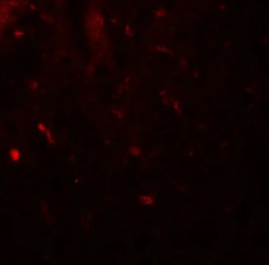 IHC-P analysis of human spleen tissue using GTX31609 MALT1 antibody. Working concentration : 20 microg/ml
