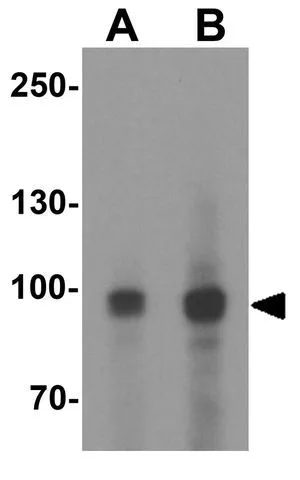 WB analysis of EL4 cell lysate using GTX31609 MALT1 antibody. Working concentration : (A) 1 and (B) 2 microg/ml