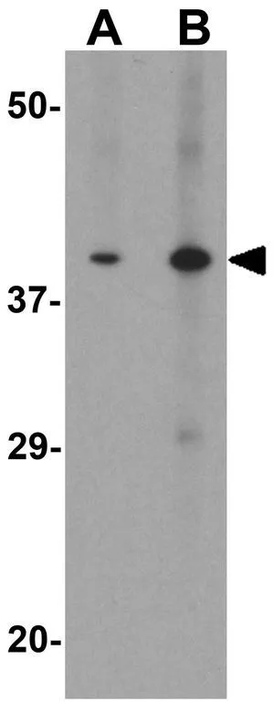 WB analysis of mouse kidney tissue lysate using GTX31610 TRIB3 antibody. Working concentration : (A) 1 and (B) 2 microg/ml