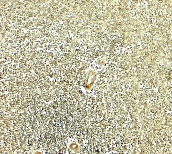 IHC-P analysis of human spleen tissue using GTX31612 HELIOS antibody. Working concentration : 5 microg/ml IHC-P analysis of human spleen tissue using GTX31612 HELIOS antibody. Working concentration : 5 microg/ml