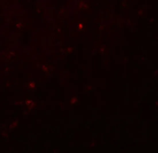 IHC-P analysis of human spleen tissue using GTX31612 HELIOS antibody. Working concentration : 20 microg/ml