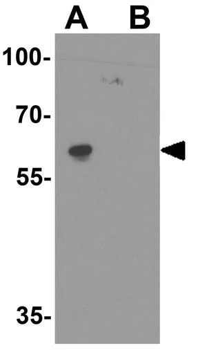 WB analysis of EL4 cell lysate in (A) the absence and (B) the presence of blocking peptide using GTX31612 HELIOS antibody. Working concentration : 1 microg/ml