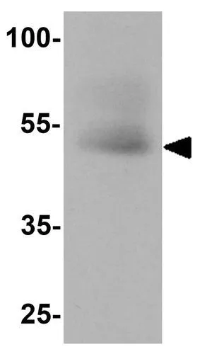WB analysis of human testis tissue lysate using GTX31613 SOX4 antibody. Working concentration : 1 microg/ml