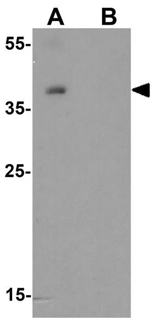 WB analysis of human colon tissue lysate in (A) the absence and (B) the presence of blocking peptide using GTX31615 DNAJA4 antibody. Working concentration : 1 microg/ml WB analysis of human colon tissue lysate in (A) the absence and (B) the presence of blocking peptide using GTX31615 DNAJA4 antibody. Working concentration : 1 microg/ml