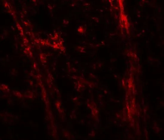 IHC-P analysis of mouse brain tissue using GTX31616 ODZ3 antibody. Working concentration : 20 microg/ml