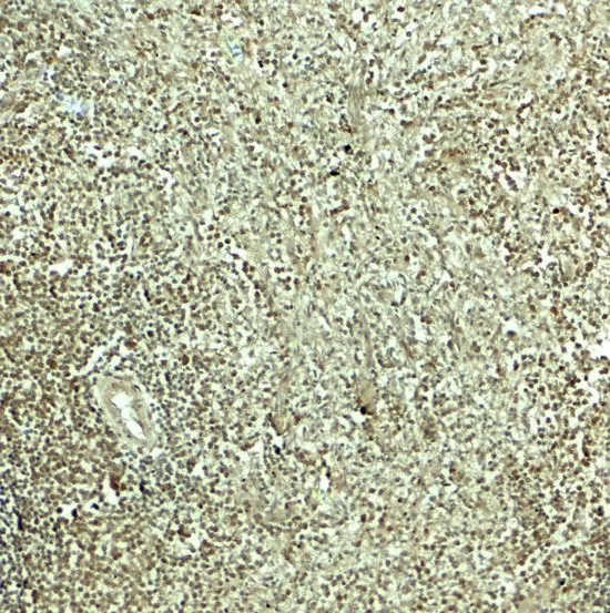 IHC-P analysis of human spleen tissue using GTX31617 SNRPN antibody. Working concentration : 5 microg/ml IHC-P analysis of human spleen tissue using GTX31617 SNRPN antibody. Working concentration : 5 microg/ml