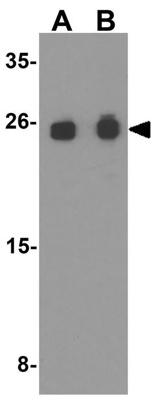 WB analysis of THP-1 cell lysate using GTX31617 SNRPN antibody. Working concentration : (A) 0.5 and (B) 1 microg/ml
