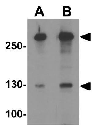 WB analysis of SK-N-SH cell lysate using GTX31619 ARID1A antibody. Working concentration : (A) 1 and (B) 2 microg/ml