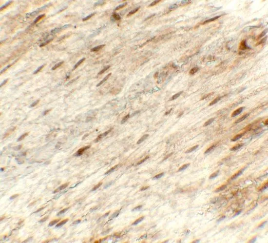 IHC-P analysis of rat stomach tissue using GTX31625 Hexokinase 1 antibody. Working concentration : 5 microg/ml IHC-P analysis of rat stomach tissue using GTX31625 Hexokinase 1 antibody. Working concentration : 5 microg/ml