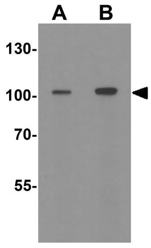 WB analysis of rat bladder tissue lysate using GTX31625 Hexokinase 1 antibody. Working concentration : (A) 1 and (B) 2 microg/ml