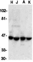WB analysis of HeLa (H), Jurkat (J), A431 (A), and K562 (K) whole cell lysate using GTX31635 ICAD antibody. Working concentration : 1:1000