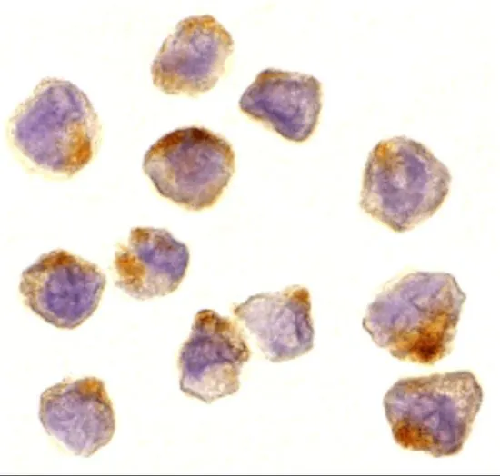 ICC/IF analysis of A431 cells using GTX31637 ASK1 antibody. Working concentration : 10 microg/ml ICC/IF analysis of A431 cells using GTX31637 ASK1 antibody. Working concentration : 10 microg/ml