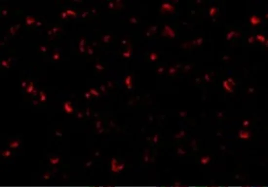 ICC/IF analysis of A431 cells using GTX31637 ASK1 antibody. Working concentration : 20 microg/ml