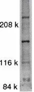 WB analysis of SW1353 cell lysate using GTX31637 ASK1 antibody. Working concentration : 1:500