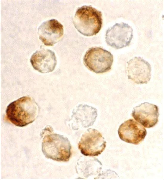 ICC/IF analysis of HeLa cells using GTX31645 IKK beta antibody. Working concentration : 10 microg/ml