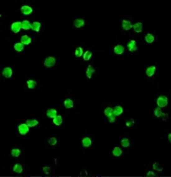 ICC/IF analysis of MOLT4 cells using GTX31646 DRAK1 antibody. Working concentration : 20 microg/ml ICC/IF analysis of MOLT4 cells using GTX31646 DRAK1 antibody. Working concentration : 20 microg/ml