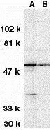 WB analysis of (A) MOLT4 and (B) A431 whole cell lysates using GTX31646 DRAK1 antibody. Working concentration : 1 microg/ml