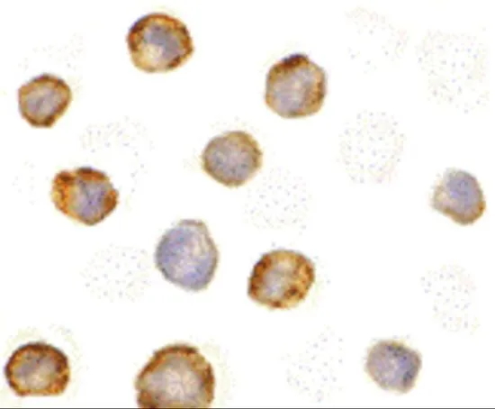 ICC/IF analysis of K562 cells using GTX31647 RIP2 antibody. Working concentration : 5 microg/ml ICC/IF analysis of K562 cells using GTX31647 RIP2 antibody. Working concentration : 5 microg/ml