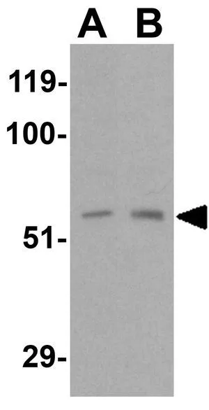 WB analysis of (A) 3T3 and (B) K562 cell lysate using GTX31647 RIP2 antibody. Working concentration : 0.5 microg/ml