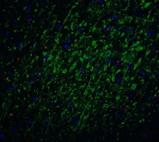 IHC-P analysis of mouse brain tissue using GTX31651 Survivin antibody. Working concentration : 20 microg/ml Green : Primary antibody Blue : DAPI Red : Actin