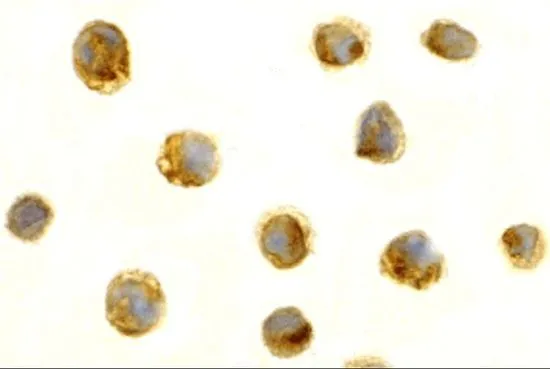 ICC/IF analysis of Jurkat cells using GTX31651 Survivin antibody. Working concentration : 5 microg/ml