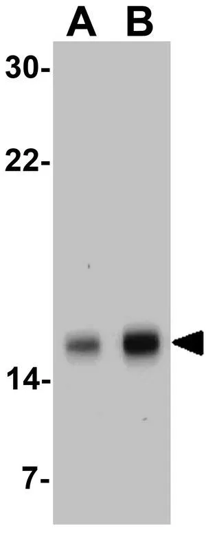 WB analysis of MOLT4 cell lysate using GTX31651 Survivin antibody. Working concentration : (A) 1 and (B) 2 microg/ml