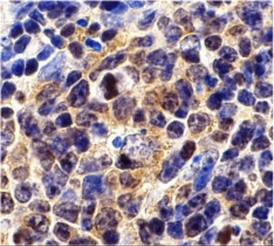 IHC-P analysis of mouse spleen tissue using GTX31653 Survivin antibody. Working concentration : 10 microg/ml IHC-P analysis of mouse spleen tissue using GTX31653 Survivin antibody. Working concentration : 10 microg/ml