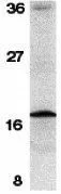 WB analysis of mouse spleen tissue lysate using GTX31653 Survivin antibody. Working concentration : 1 microg/ml