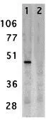 IHC-P analysis of human small intestine tissue using GTX31657 DC-SIGN antibody. Working concentration : 10 ug/ml